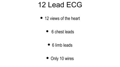 leads on ecg